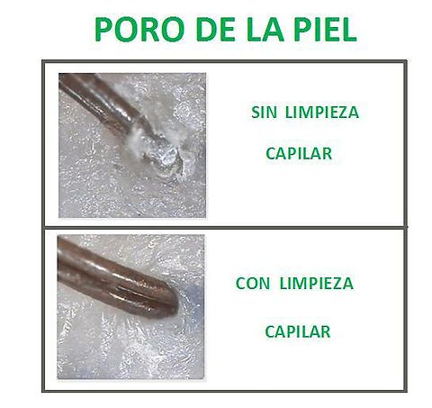 ¿PORQUÉ SON TAN IMPORTANTES LAS LIMPIEZAS CAPILARES?